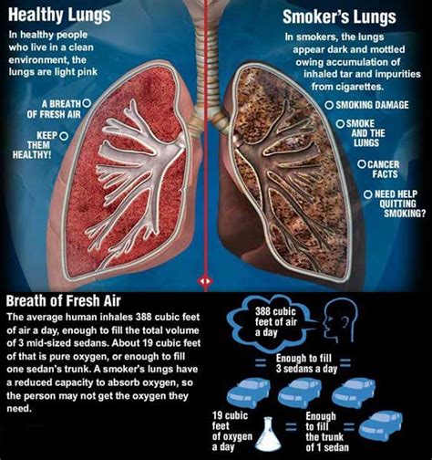 Symptoms of #smokers #cough and #nicotine replacement therapy - # ...