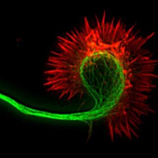 Fluorescence image of a cortical axon and its growth cone. Actin... | Download Scientific Diagram