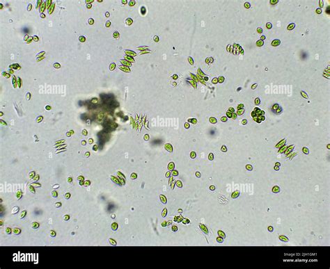 Blue green algae microscope hi-res stock photography and images - Alamy