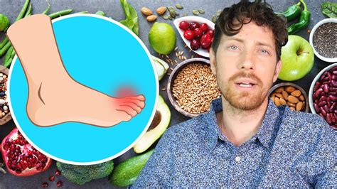 Vegan Diet vs Gout: Home Remedy? - YouTube