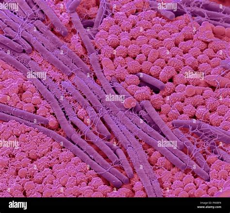 Tongue bacteria. Coloured scanning electron micrograph (SEM) of ...