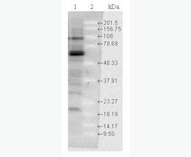 Anti-Hsp70 antibody (ab79852) | Abcam