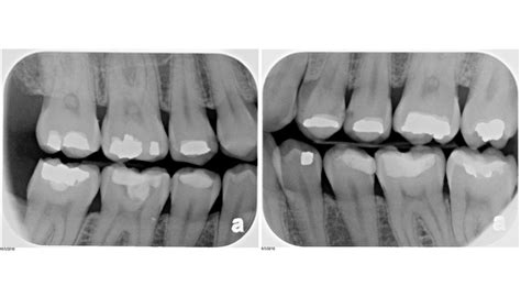 Dental News and Views: Initial Dental Exam