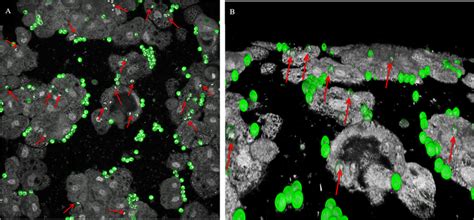 Confocal imaging (A) and 3D projection (B) of co-incubated free-living ...