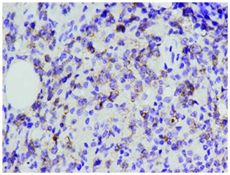 CD30 Antibody (Monoclonal, Ber-H2)