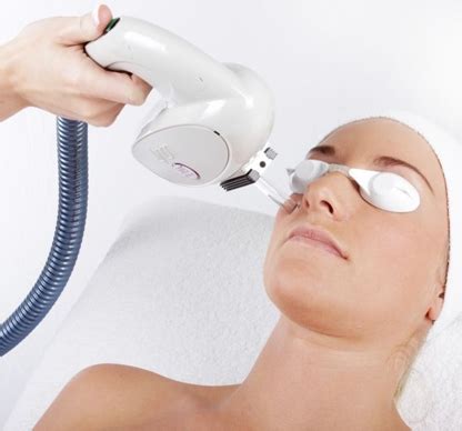 KTP Diode Laser Treatment Toronto | Fairview Laser Clinic Inc.