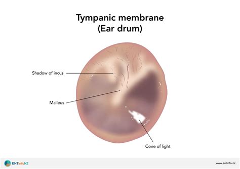 Myringoplasty and tympanoplasty - ENT Info