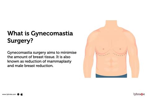 Gynecomastia Surgery: Purpose, Procedure, Benefits and Side Effects