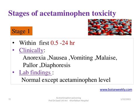 Acetaminophen poisoning