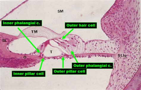 Cochlea Histology Flashcards | Quizlet