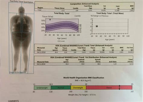 DEXA Scan Results: 30, 5'7", 260 lbs, 52.6% BF : xxfitness