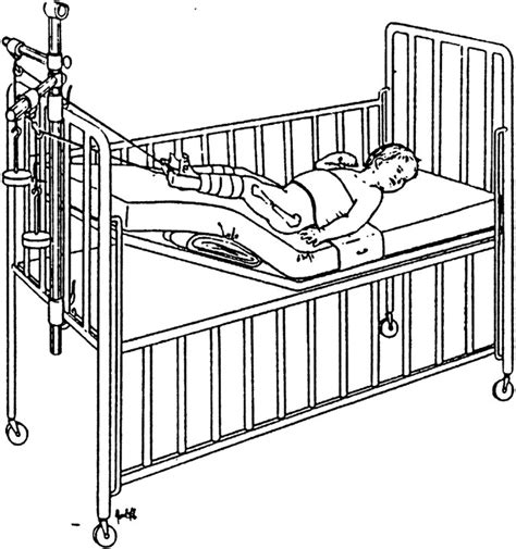 Common Procedures in Pediatric Orthopaedics | Musculoskeletal Key