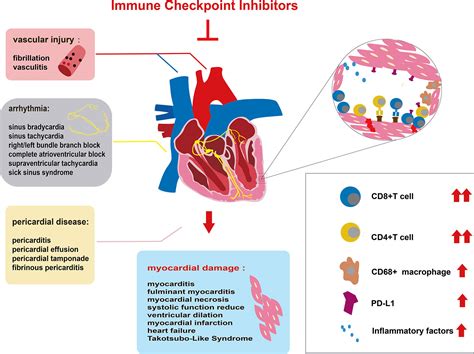 Frontiers | Immune Checkpoint Inhibitor-Associated Cardiotoxicity ...