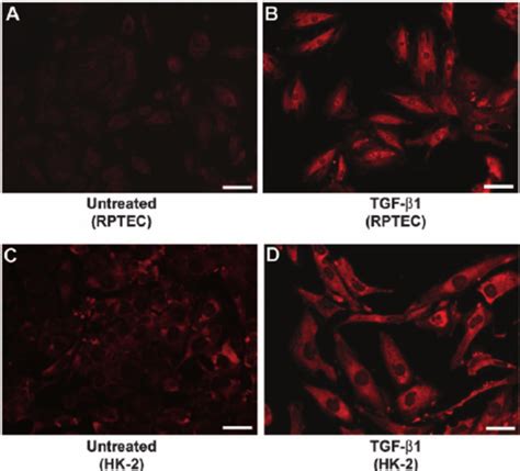 TGF- β 1 induced α -smooth muscle actin expression in primary and ...