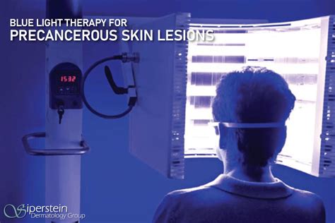 FAQs About Blue Light Therapy For Precancerous Skin Lesions