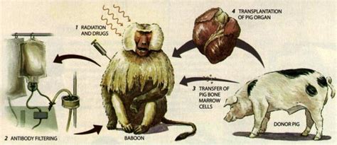 Animal organs for human transplantation: how close are we