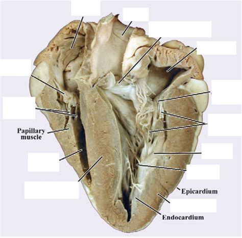 Cow Heart (internal anatomy) Diagram | Quizlet