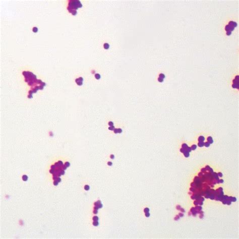 Typical Coccus Bacteria Microscope Slides, w.m. | Carolina Biological ...