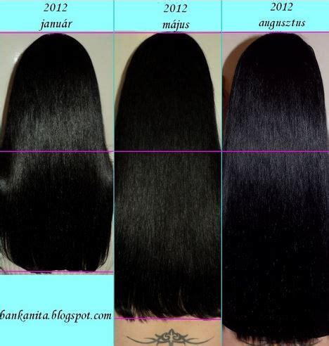 Biotin for Hair Growth, How Much to Take, Dosage, 1000 mcg Results ...