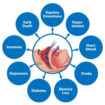 Symptoms of Sleep Apnea