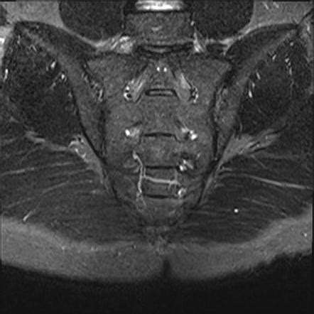 Playlist 'Sacroiliac Joint - 0 Normal / References' by Daniel Teh