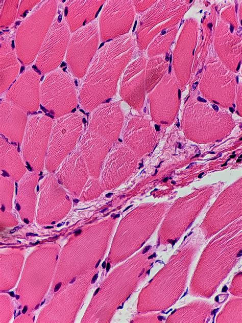 Skeletal Muscle Cross Section