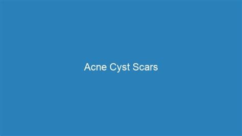 Acne Cyst Scars | Acne Complex Treatments