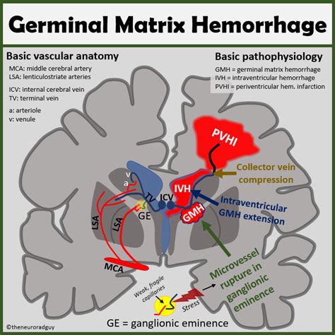 Germinal Matrix Brain Anatomy