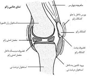 نرمی غضروف زانو - کلینیک مغز و اعصاب و درد | مرکز درمان دیسک کمر و گردن درد