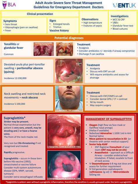 Deviated Uvula Sore Throat