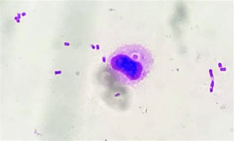 Gram staining of urine specimens showing phagocytosed gram-negative rod... | Download Scientific ...