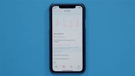 Hands-On With the ECG Feature for Apple Watch Series 4 - MacRumors