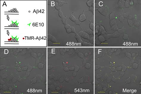 9 Cell surface aggregation of Aβ. All scale bars are 20 µm in length.... | Download Scientific ...