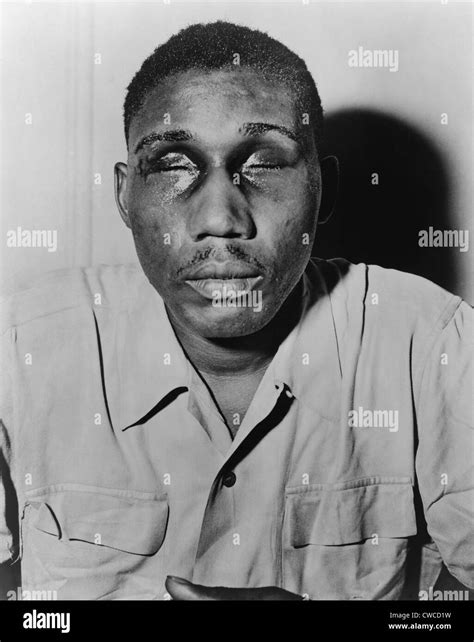 African american man eyes swollen hi-res stock photography and images - Alamy