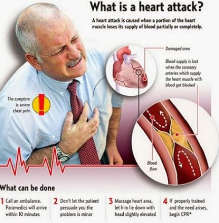 Heart Attack Symptoms, Causes, And What To Do