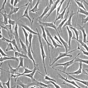 Human Trabecular Meshwork Cells – Cells Online