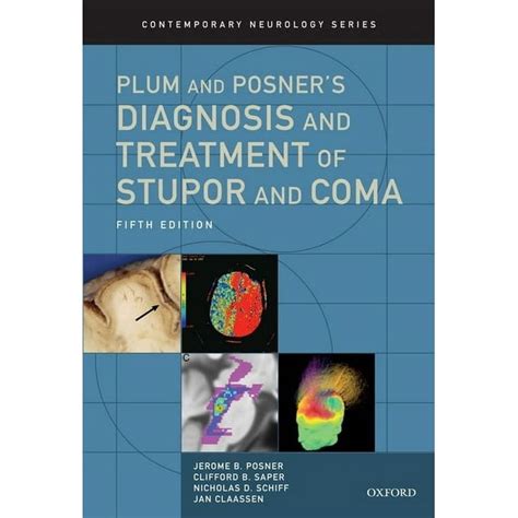 Contemporary Neurology: Plum and Posner's Diagnosis and Treatment of Stupor and Coma (Hardcover ...