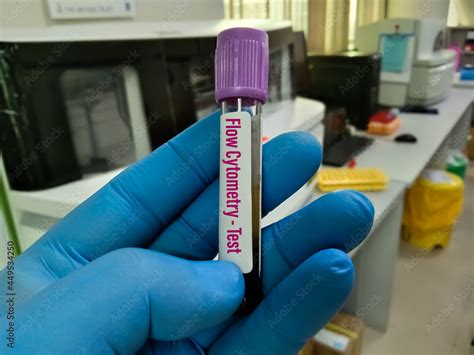 Blood sample tube for Flow Cytometry, CD3/CD4/CD8, Regulatory T cells ...