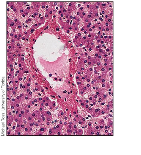 Histology of the liver lobule Diagram | Quizlet