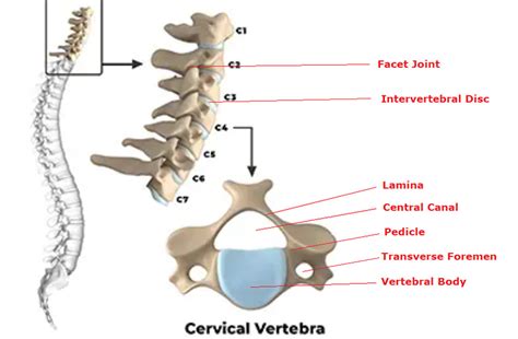 Cervical Spine Surgery Bridgewater MA | Cervical Spine Treatments ...