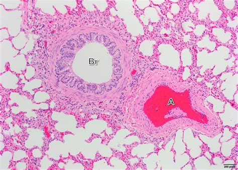 Air conduction: Larynx, Trachea, Bronchi and Bronchioles – Veterinary ...