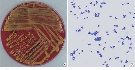 Figure 1 from A Case of Catheter-related Kocuria marina Bloodstream Infection in a Patient with ...