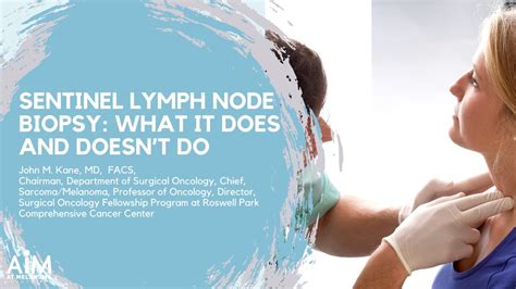 Sentinel lymph node biopsy groin - profwery