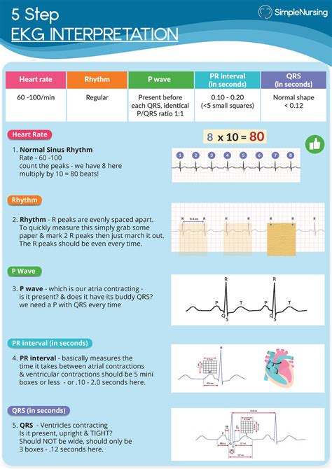 5 step EKG interpretation - 5 Step EKG INTERPRETATION Heart rate Rhythm P wave PR interval (in ...