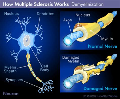 All About The Spinal Cord and Its Importance | HubPages