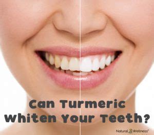 Does Turmeric Stain or Whiten Your Teeth?