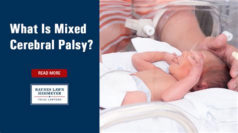 What Is Mixed Cerebral Palsy? | Raynes Lawn Hehmeyer