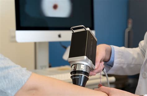 Mole Mapping | Melanoma Skin Cancer - Toronto Dermatology Centre