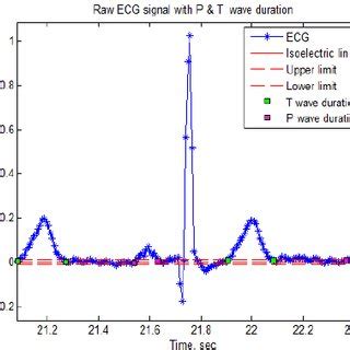 ECG signal with isoelectric line and P and T wave durations | Download Scientific Diagram