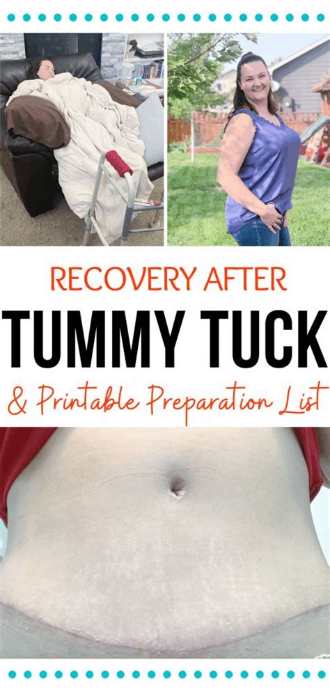 Tummy Tuck Preparation List & Recovery | Tummy tuck surgery, Tummy ...